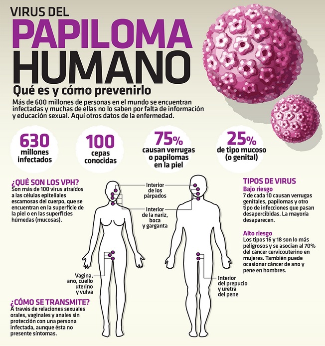 Aumentan casos de verrugas genitales causadas por el virus del papiloma