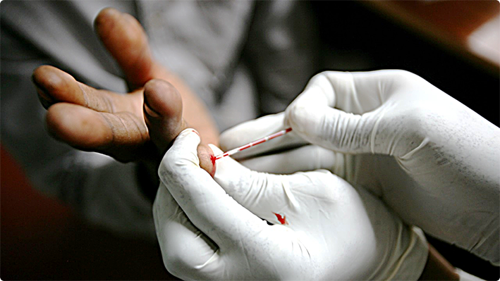 Dejó de ser obligatorio contar con un certificado para el testeo del VIH