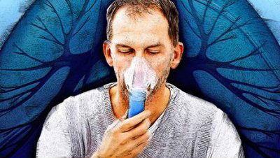 Fibrosis pulmonar: hay una nueva esperanza