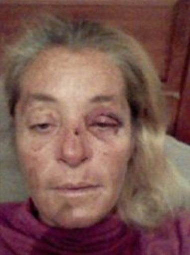 La mujer que denunció a su expareja por agresiones fue golpeada por su excuñada